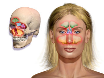 Комьютерная томография пазух носа
